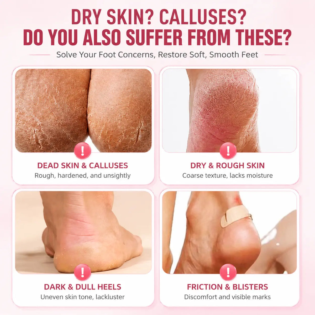 🔥 Reusable Silicone Moisturizing Foot Socks – Hydrating Gel Heel Masks for Dry, Cracked Feet